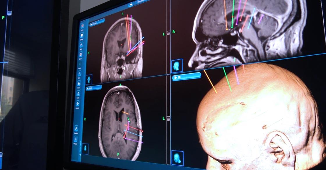 Stealth Station Surgical Navigation System QEII Foundation