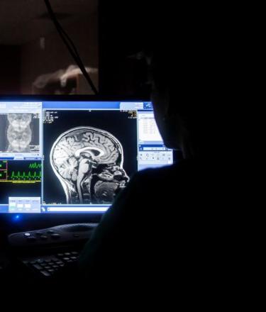 An image of a brain scan shown on a computer screen.