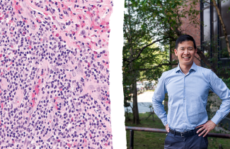 Strain of lymphocytic variant hyper eosinophilic syndrome (L-HES) magnified x20 (left) Dr. Luke Chen, rare disease specialist at the QEII, who made the first diagnosis of L-HES in Atlantic Canada (right). 