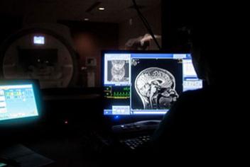 An image of a brain scan shown on a computer screen.